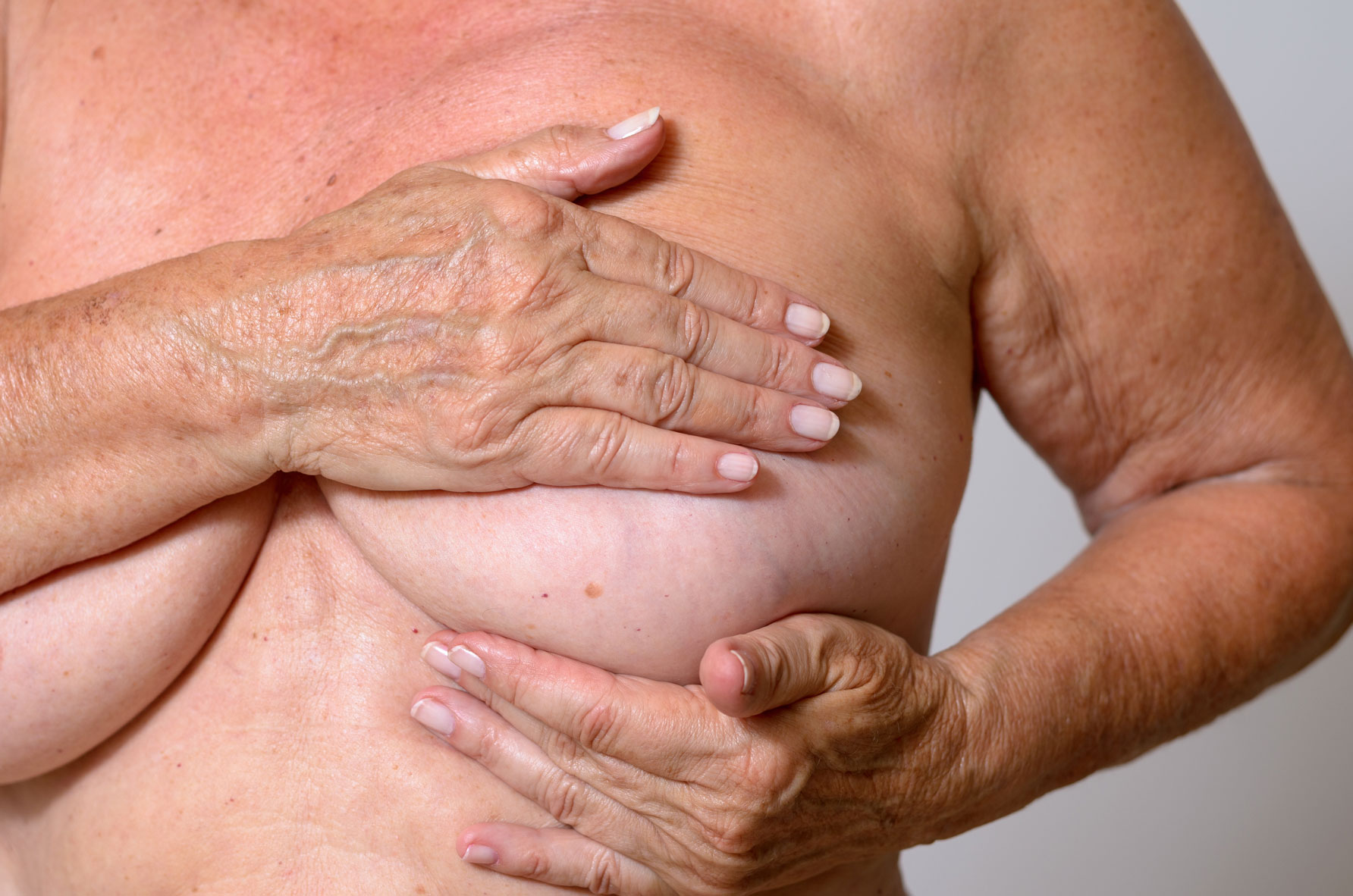 первые признаки онкологии груди у женщин фото 86